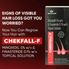 Chekfall-F 5% Topical Solution, 60ml